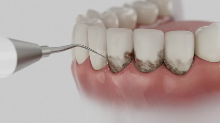 Reliable Emergency Dentist contractor in Chanute, KS by Smile Center Dentistry